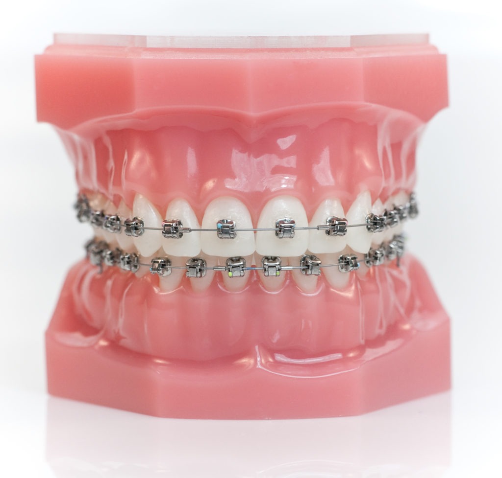 irving orthodontics