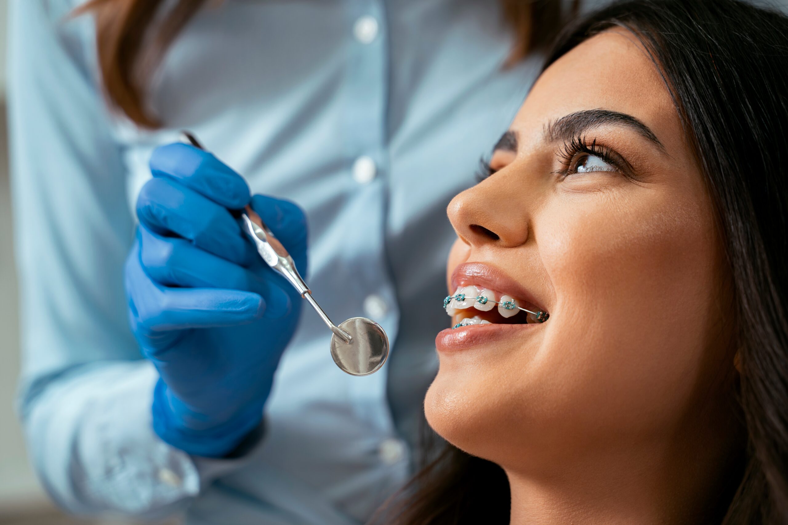 Why Irving Families Trust Ward Orthodontics for Braces & Clear Aligners
